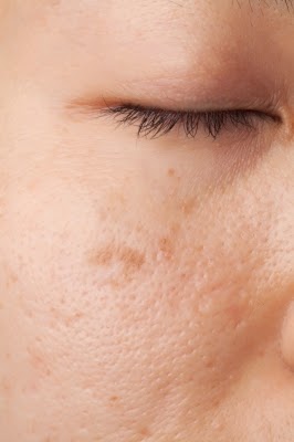 Lavender rayne interracial Brown facial spot